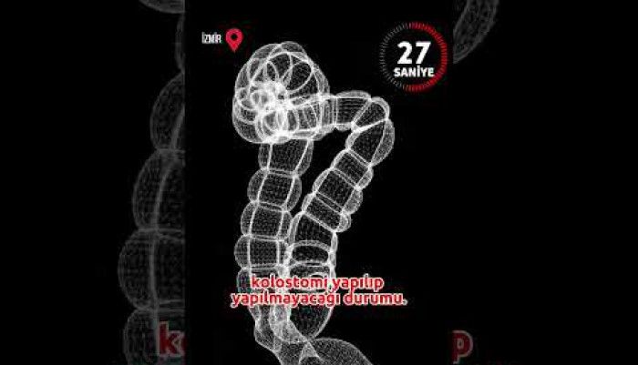 video,paylaşım,kameralı telefon,videofon,ücretsiz,yükleme